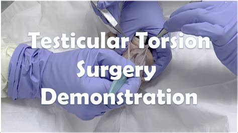 best least expensive way to test for testicular torsion|testicular torsion surgery guidelines.